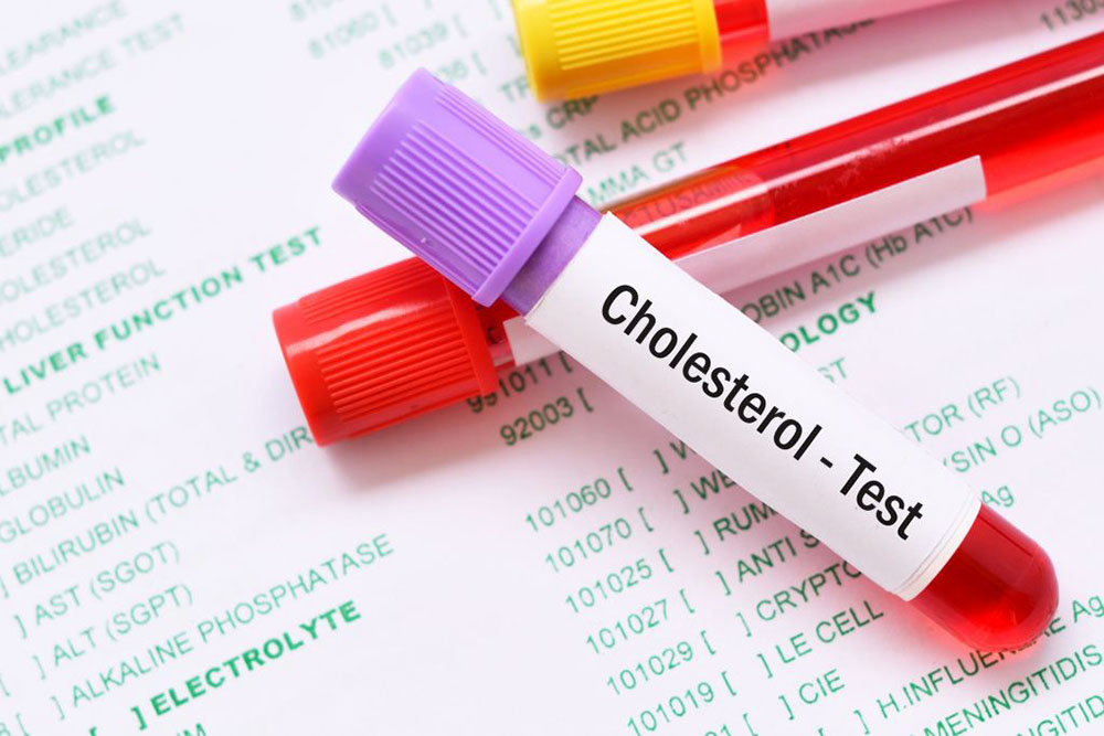Prawidłowy cholesterol – jakie ma znaczenie i jakie są normy cholesterolu dla kobiet i mężczyzn?