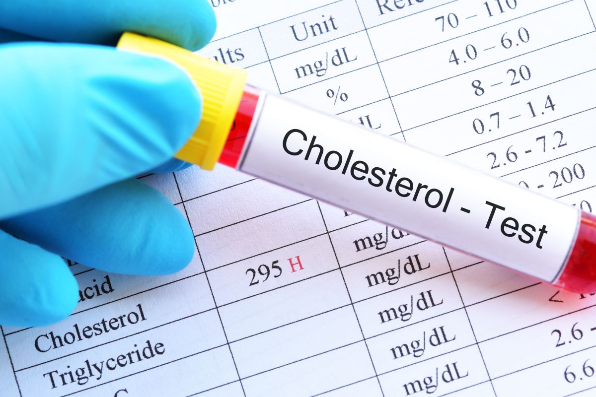 Czy warto dbać o poziom cholesterolu?
